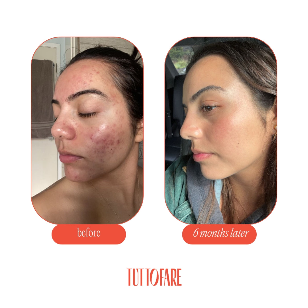 Roman Blue Tallow Balm Natural Skincare TUTTOFARE roman-blue-tallow-balm-natural-skincare-tuttofare